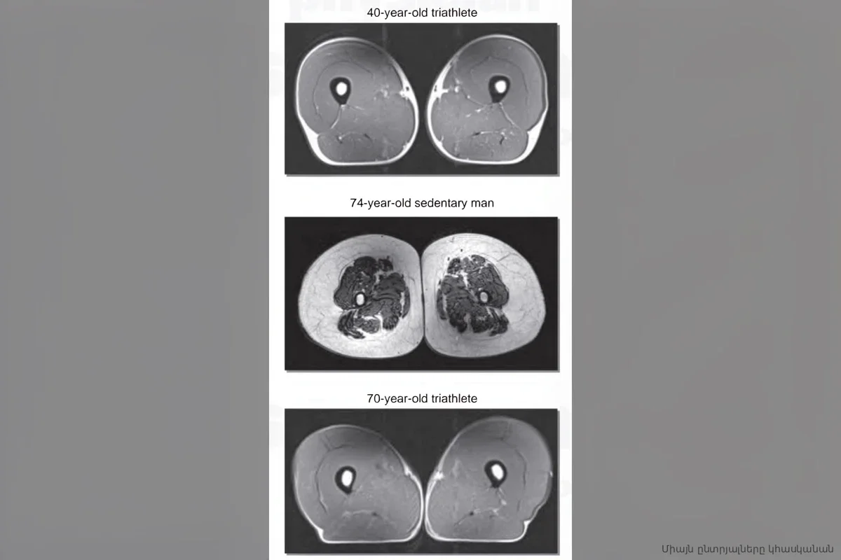 МРТ показало, во что превращаются мышцы от фастфуда даже при регулярных тренировках